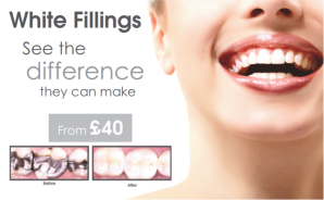Ask about white fillings